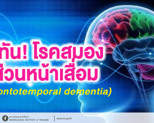 กรมการแพทย์ แนะรู้ทัน! โรคสมองส่วนหน้าเสื่อม (Frontotemporal dementia)